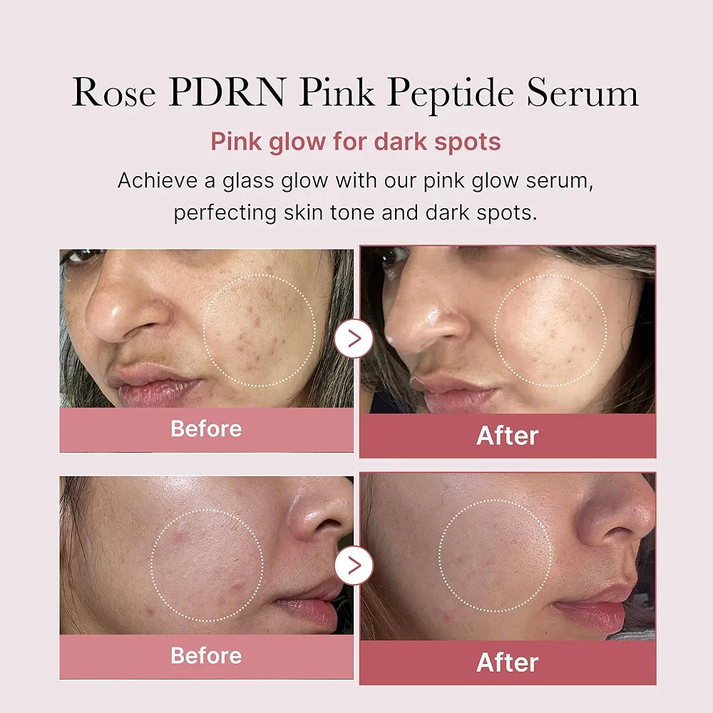 MEDICUBE - PDRN Pink Peptide Serum - 30ml