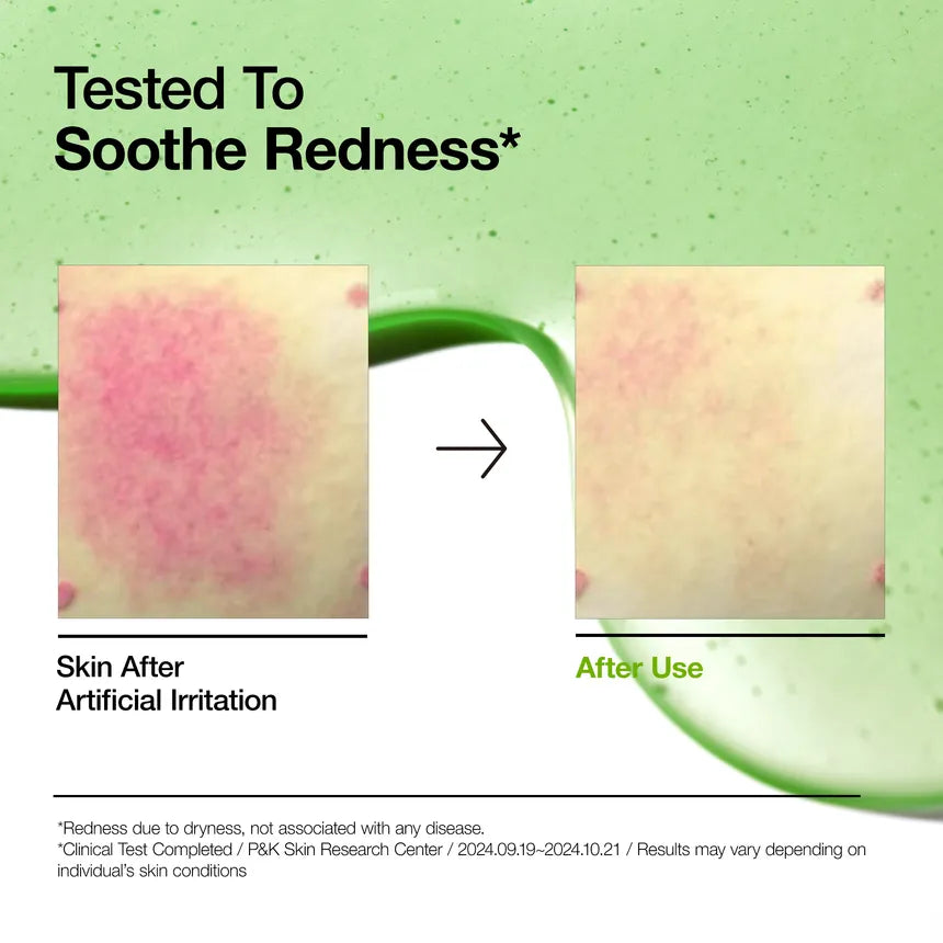 ANUA 10+AZELAIC ACID 10 HYALURON REDNESS SOOTHING SERUM 30 ML
